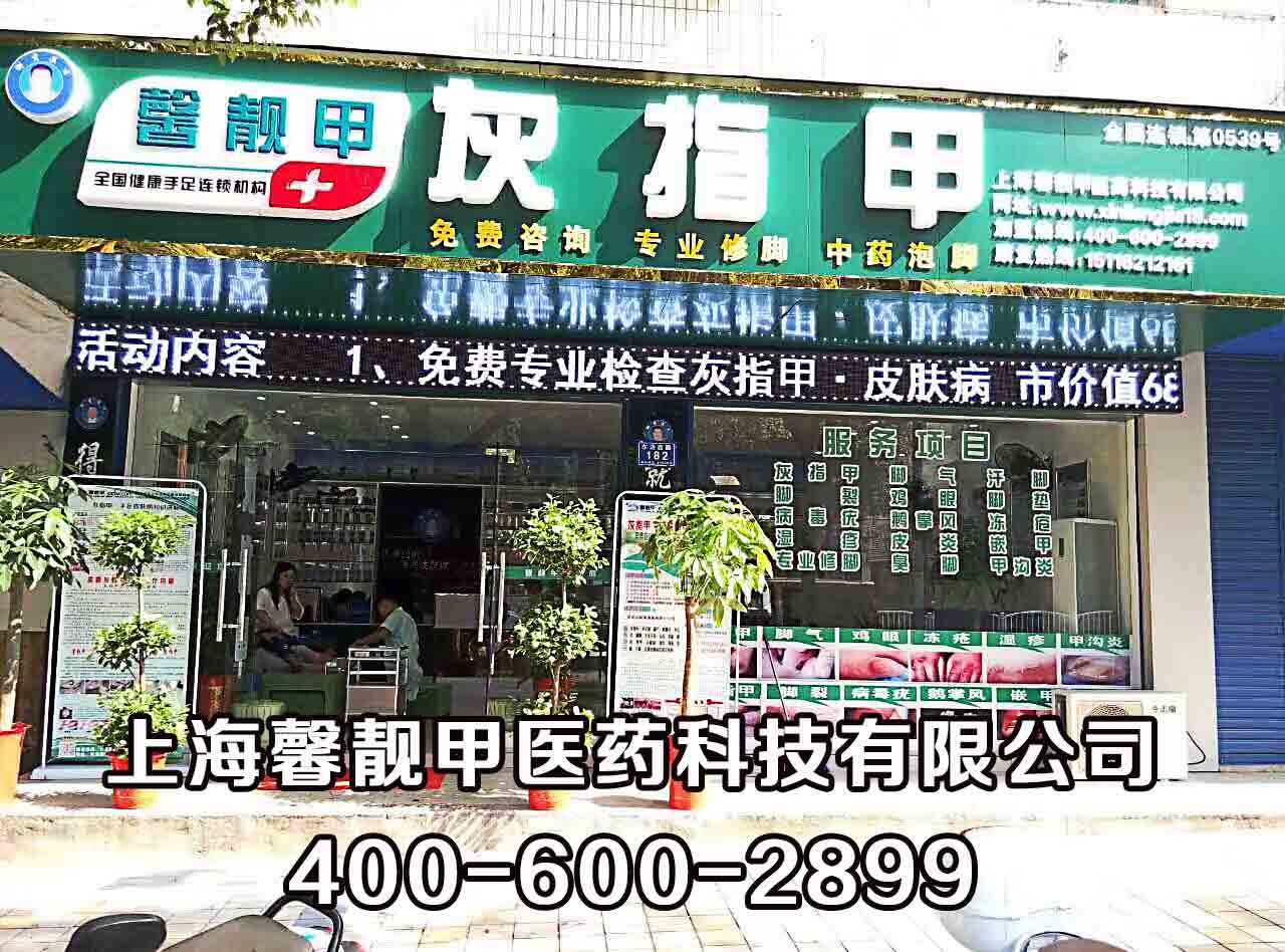 灰指甲连锁店适宜开在哪些地方