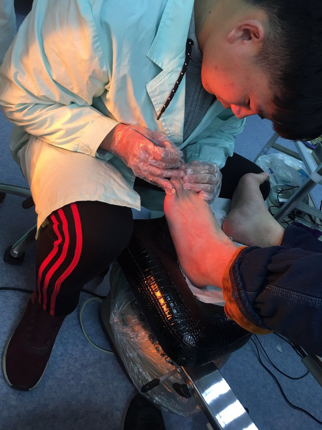 哪里治疗灰指甲效果好