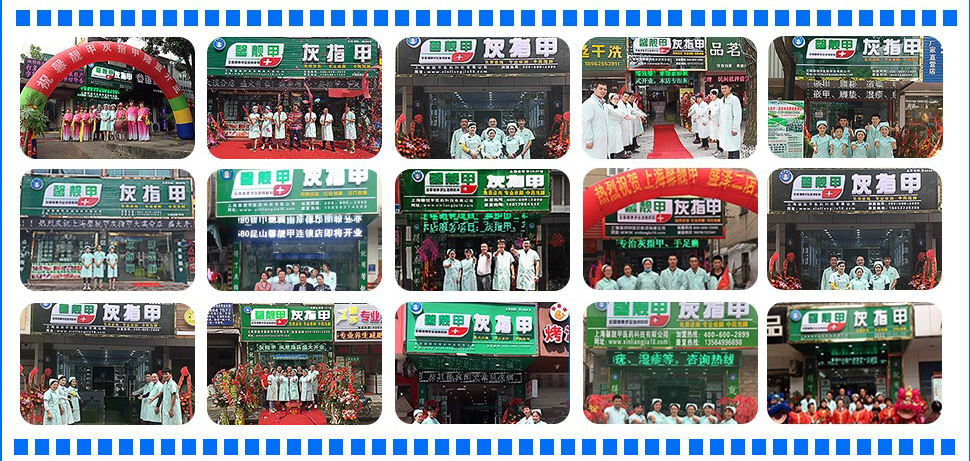 加盟灰指甲有没有发展 加盟可以合伙投资吗