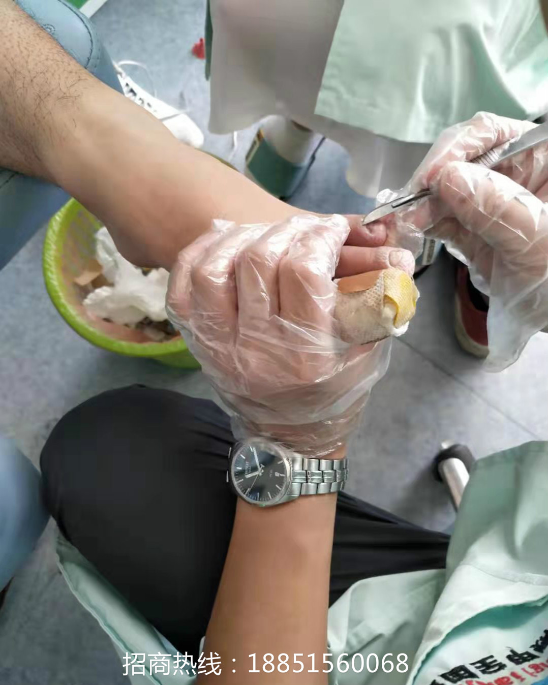 灰指甲连锁加盟店